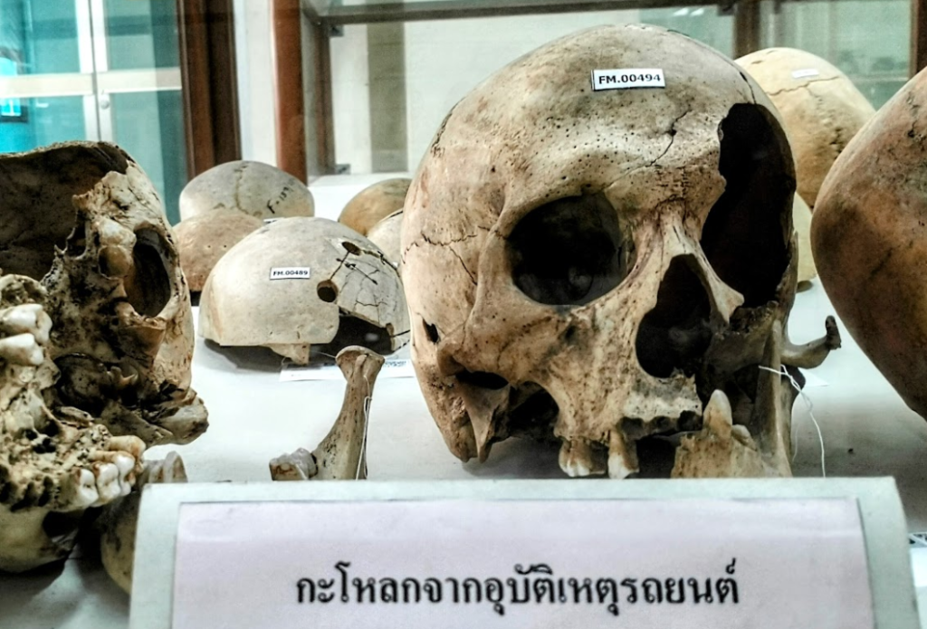 Siriraj Medical Museum squelette accident